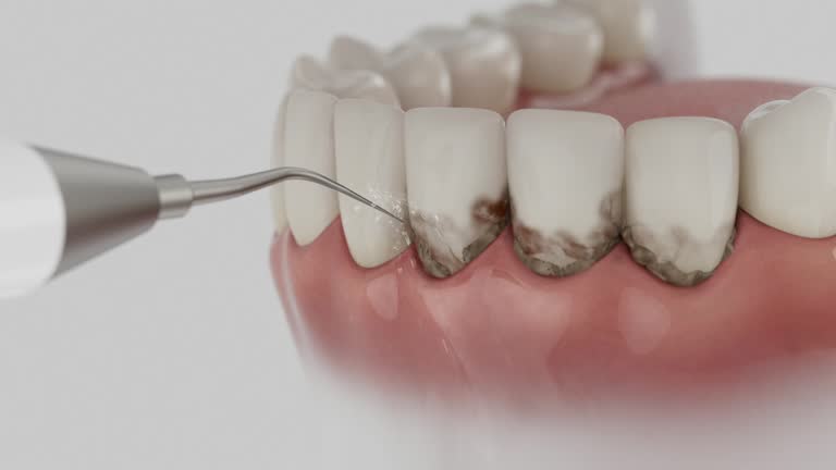 Reliable Emergency Dentist contractor in Belle, MO by Smile Center Dentistry